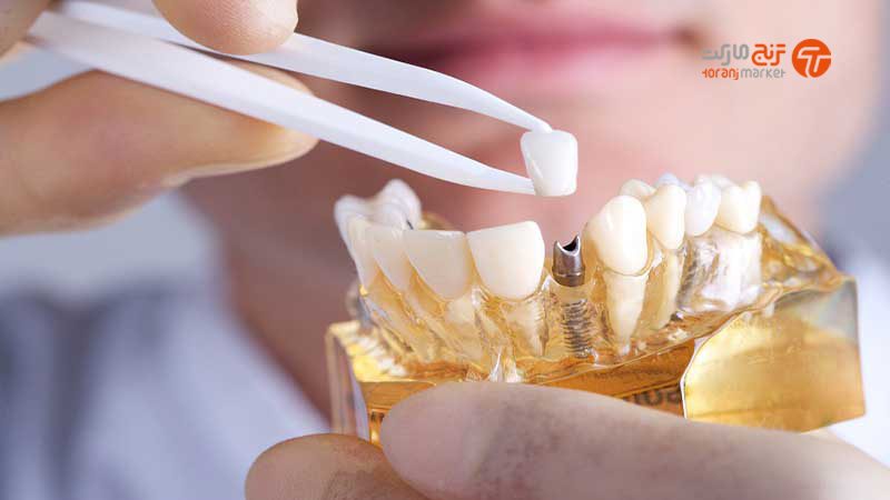 تکنسین پروتزهای دندانی